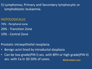 5) Lymphomas; Primary and Secondary lymphocytic or
lymphoblastic leukaemia.
HISTOLOGICALLY;
70% - Peripheral zone
20% - Transition Zone
10% - Central Zone
Prostatic intraepithelial neoplasia.
• Benign acini lined by intraductal dysplasia
• Can be low grade(PIN I) ass. with BPH or high grade(PIN II)
ass. with Ca in 30-50% of cases. Medrockets.com
 
