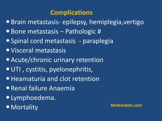 Brain metastasis- epilepsy, hemiplegia,vertigo
Bone metastasis – Pathologic #
Spinal cord metastasis - paraplegia
Visceral metastasis
Acute/chronic urinary retention
UTI , cystitis, pyelonephritis,
Heamaturia and clot retention
Renal failure Anaemia
Lymphoedema.
Mortality
Complications
Medrockets.com
 
