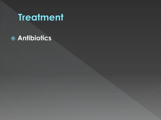  Antibiotics