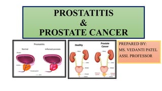 PROSTATITIS
&
PROSTATE CANCER
PREPARED BY:
MS. VEDANTI PATEL
ASSI. PROFESSOR
 