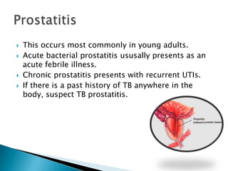    This occurs most commonly in young adults.
   Acute bacterial prostatitis ususally presents as an
    acute febrile illness.
   Chronic prostatitis presents with recurrent UTIs.
   If there is a past history of TB anywhere in the
    body, suspect TB prostatitis.
 