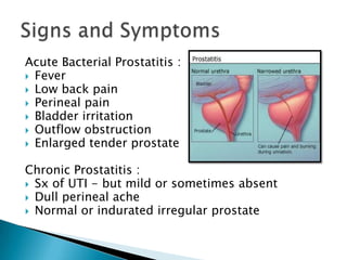 Acute Bacterial Prostatitis :
 Fever
 Low back pain
 Perineal pain
 Bladder irritation
 Outflow obstruction
 Enlarged tender prostate


Chronic Prostatitis :
 Sx of UTI - but mild or sometimes absent
 Dull perineal ache
 Normal or indurated irregular prostate
 