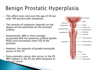    This affect most men over the age of 50 but
    only 10% present with symptoms.

   The severity of symptoms depends on the
    degree of encroachment on the prostatic
    urethra.

   Anatomically, BPH is most strongly
    associated with the posterior urethral glands
    (PUG) and transitional zone (TZ) of the
    prostate.

   However, the majority of growth eventually
    occurs in the TZ.

   Since prostatic cancer also occurs in the PZ,
    BPH nodules in the PZ are often biopsied to
    rule out cancer
 
