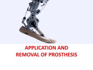 APPLICATION AND
REMOVAL OF PROSTHESIS
 