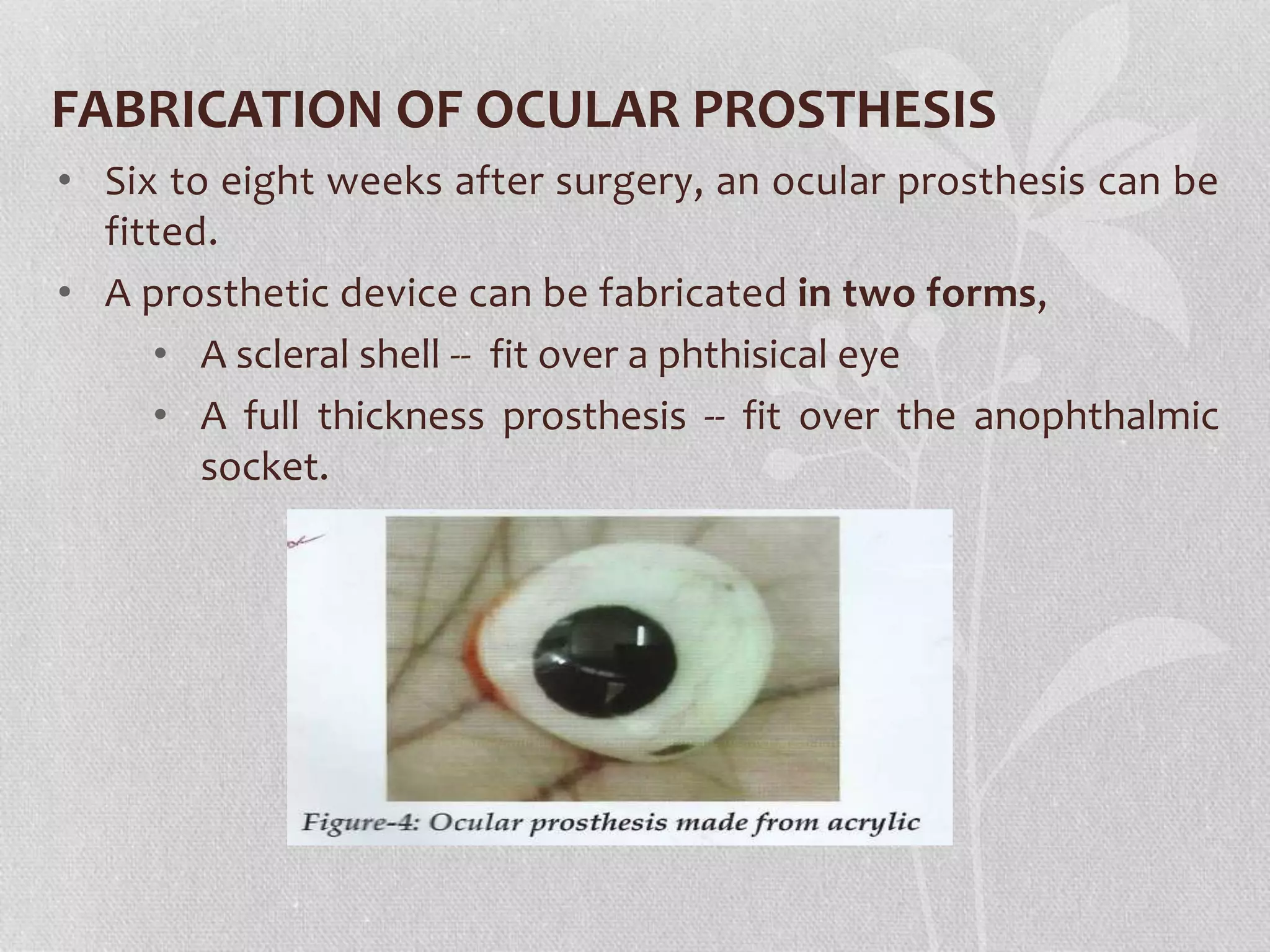 FABRICATION OF OCULAR PROSTHESIS
• Six to eight weeks after surgery, an ocular prosthesis can be
fitted.
• A prosthetic device can be fabricated in two forms,
• A scleral shell -- fit over a phthisical eye
• A full thickness prosthesis -- fit over the anophthalmic
socket.
 