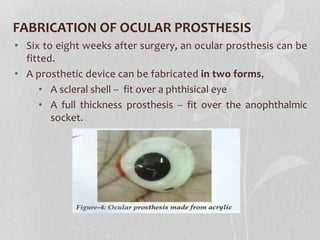 FABRICATION OF OCULAR PROSTHESIS
• Six to eight weeks after surgery, an ocular prosthesis can be
fitted.
• A prosthetic device can be fabricated in two forms,
• A scleral shell -- fit over a phthisical eye
• A full thickness prosthesis -- fit over the anophthalmic
socket.
 