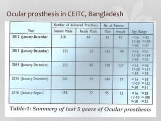 Ocular prosthesis in CEITC, Bangladesh
 