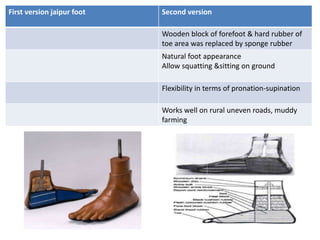First version jaipur foot Second version
Wooden block of forefoot & hard rubber of
toe area was replaced by sponge rubber
Natural foot appearance
Allow squatting &sitting on ground
Flexibility in terms of pronation-supination
Works well on rural uneven roads, muddy
farming
 