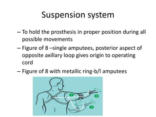 Suspension system
– To hold the prosthesis in proper position during all
possible movements
– Figure of 8 –single amputees, posterior aspect of
opposite axillary loop gives origin to operating
cord
– Figure of 8 with metallic ring-b/l amputees
 