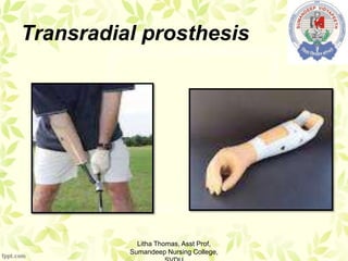 Transradial prosthesis
Litha Thomas, Asst Prof,
Sumandeep Nursing College,
 