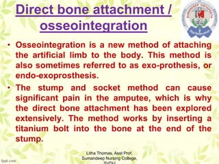 Direct bone attachment /
osseointegration
• Osseointegration is a new method of attaching
the artificial limb to the body. This method is
also sometimes referred to as exo-prothesis, or
endo-exoprosthesis.
• The stump and socket method can cause
significant pain in the amputee, which is why
the direct bone attachment has been explored
extensively. The method works by inserting a
titanium bolt into the bone at the end of the
stump.
Litha Thomas, Asst Prof,
Sumandeep Nursing College,
 