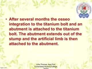 • After several months the osseo
integration to the titanium bolt and an
abutment is attached to the titanium
bolt. The abutment extends out of the
stump and the artificial limb is then
attached to the abutment.
Litha Thomas, Asst Prof,
Sumandeep Nursing College,
 
