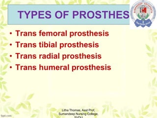 TYPES OF PROSTHESIS
• Trans femoral prosthesis
• Trans tibial prosthesis
• Trans radial prosthesis
• Trans humeral prosthesis
Litha Thomas, Asst Prof,
Sumandeep Nursing College,
 
