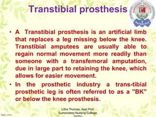 Transtibial prosthesis
• A Transtibial prosthesis is an artificial limb
that replaces a leg missing below the knee.
Transtibial amputees are usually able to
regain normal movement more readily than
someone with a transfemoral amputation,
due in large part to retaining the knee, which
allows for easier movement.
• In the prosthetic industry a trans-tibial
prosthetic leg is often referred to as a "BK"
or below the knee prosthesis.
Litha Thomas, Asst Prof,
Sumandeep Nursing College,
 