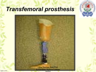 Transfemoral prosthesis
Litha Thomas, Asst Prof,
Sumandeep Nursing College,
 
