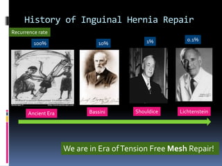 History of Inguinal Hernia Repair
We are in Era ofTension Free Mesh Repair!
10% 1% 0.1%
100%
Recurrence rate
Bassini Shouldice LichtensteinAncient Era
 