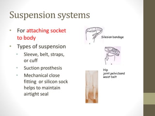 Suspension systems
• For attaching socket
to body
• Types of suspension
• Sleeve, belt, straps,
or cuff
• Suction prosthesis
• Mechanical close
fitting or silicon sock
helps to maintain
airtight seal
 