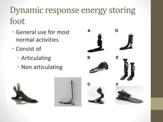 Dynamic response energy storing
foot
• General use for most
normal activities
• Consist of
• Articulating
• Non articulating
 
