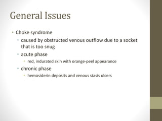 General Issues
• Choke syndrome
• caused by obstructed venous outflow due to a socket
that is too snug
• acute phase
• red, indurated skin with orange-peel appearance
• chronic phase
• hemosiderin deposits and venous stasis ulcers
 