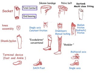 Suction&
Mechl close fitting
 