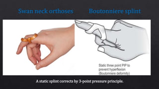 Prosthesis & Orthoses | PPTX