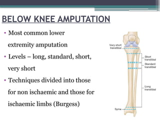 BELOW KNEE AMPUTATION
• Most common lower
extremity amputation
• Levels – long, standard, short,
very short
• Techniques divided into those
for non ischaemic and those for
ischaemic limbs (Burgess)
 