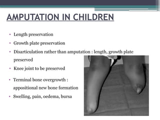 AMPUTATION IN CHILDREN
• Length preservation
• Growth plate preservation
• Disarticulation rather than amputation : length, growth plate
preserved
• Knee joint to be preserved
• Terminal bone overgrowth :
appositional new bone formation
• Swelling, pain, oedema, bursa
 