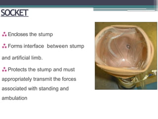 SOCKET
 Encloses the stump
 Forms interface between stump
and artificial limb.
 Protects the stump and must
appropriately transmit the forces
associated with standing and
ambulation
 
