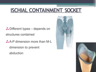 ISCHIAL CONTAINMENT SOCKET
 Different types – depends on
structures contained
A-P dimension more than M-L
dimension to prevent
abduction
 