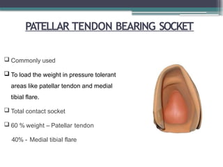 PATELLAR TENDON BEARING SOCKET
 Commonly used
 To load the weight in pressure tolerant
areas like patellar tendon and medial
tibial flare.
 Total contact socket
 60 % weight – Patellar tendon
40% - Medial tibial flare
 