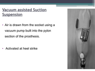 Vacuum assisted Suction
Suspension
• Air is drawn from the socket using a
vacuum pump built into the pylon
section of the prosthesis.
• Activated at heel strike
 
