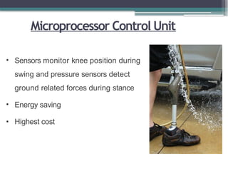 Microprocessor Control Unit
• Sensors monitor knee position during
swing and pressure sensors detect
ground related forces during stance
• Energy saving
• Highest cost
 