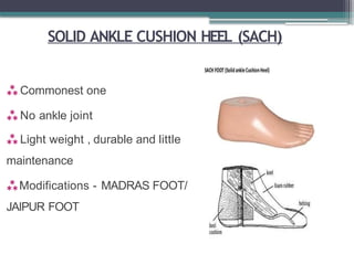 SOLID ANKLE CUSHION HEEL (SACH)
 Commonest one
 No ankle joint
 Light weight , durable and little
maintenance
Modifications - MADRAS FOOT/
JAIPUR FOOT
 