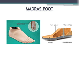 MADRAS FOOT
 