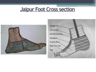 Jaipur Foot Cross section
 