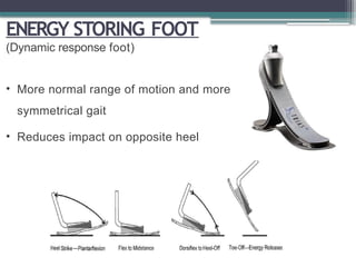 ENERGY STORING FOOT
(Dynamic response foot)
• More normal range of motion and more
symmetrical gait
• Reduces impact on opposite heel
 