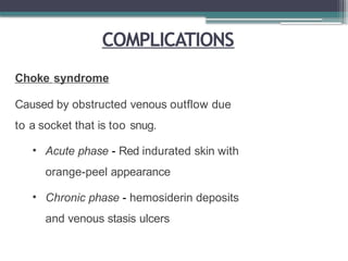 COMPLICATIONS
Choke syndrome
Caused by obstructed venous outflow due
to a socket that is too snug.
• Acute phase - Red indurated skin with
orange-peel appearance
• Chronic phase - hemosiderin deposits
and venous stasis ulcers
 