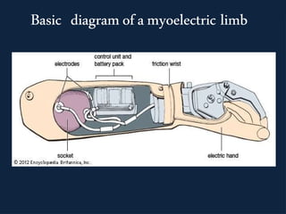 Basic diagramofamyoelectric limb
 