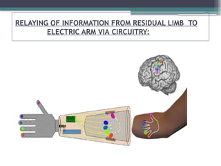 RELAYING OF INFORMATION FROM RESIDUAL LIMB TO
ELECTRIC ARM VIA CIRCUITRY:
 