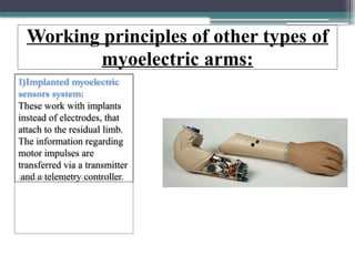 Working principles of other types of
myoelectric arms:
1)Implanted myoelectric
sensors system:
These work with implants
instead of electrodes, that
attach to the residual limb.
The information regarding
motor impulses are
transferred via a transmitter
and a telemetry controller.
 