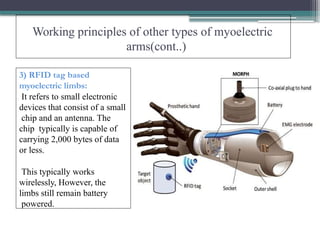 Working principles of other types of myoelectric
arms(cont..)
3) RFID tag based
myoelectric limbs:
It refers to small electronic
devices that consist of a small
chip and an antenna. The
chip typically is capable of
carrying 2,000 bytes of data
or less.
This typically works
wirelessly, However, the
limbs still remain battery
powered.
 