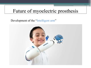 Future of myoelectric prosthesis
Development of the “Intelligent arm”
 