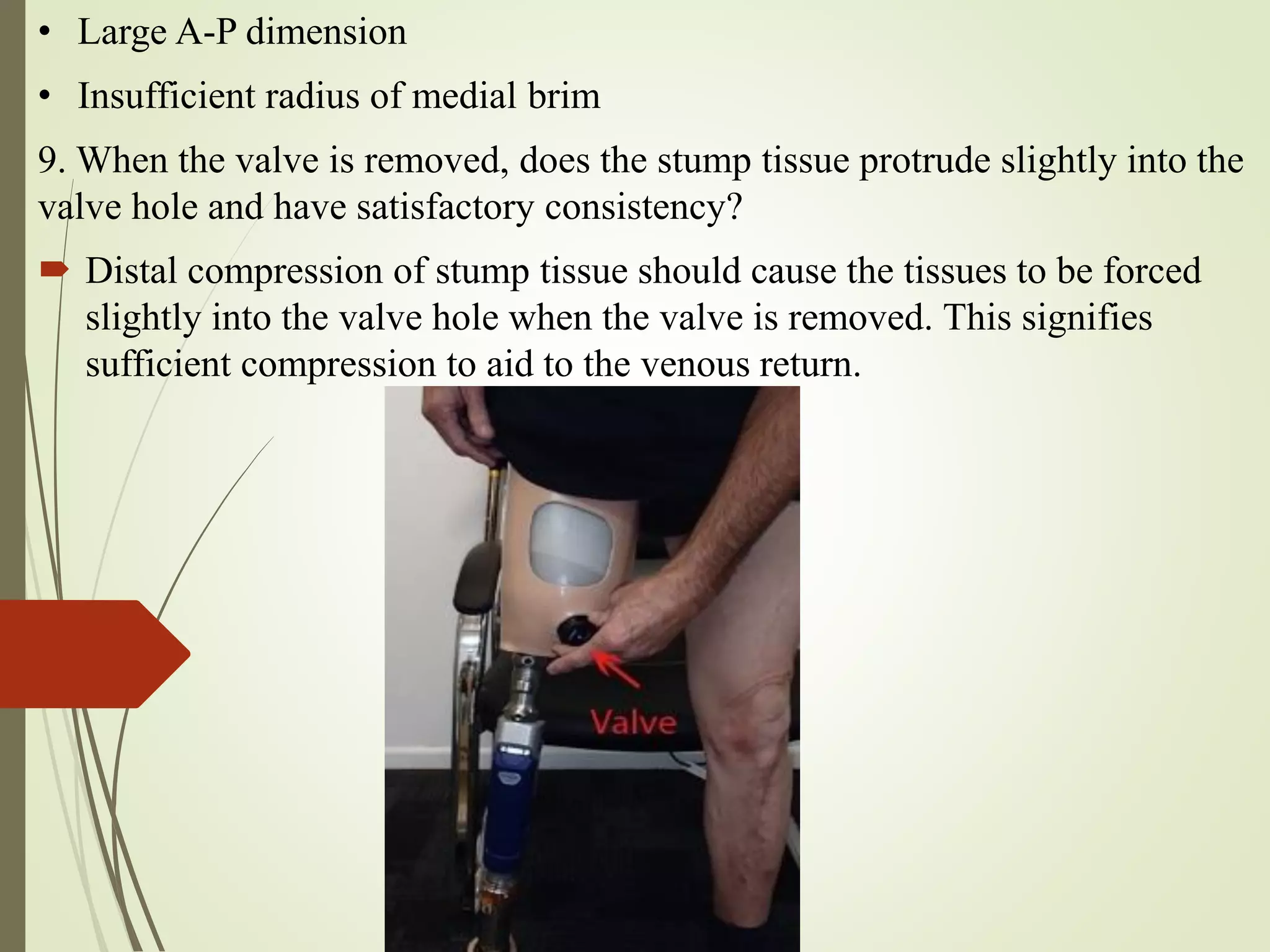 • Large A-P dimension
• Insufficient radius of medial brim
9. When the valve is removed, does the stump tissue protrude slightly into the
valve hole and have satisfactory consistency?
 Distal compression of stump tissue should cause the tissues to be forced
slightly into the valve hole when the valve is removed. This signifies
sufficient compression to aid to the venous return.
 
