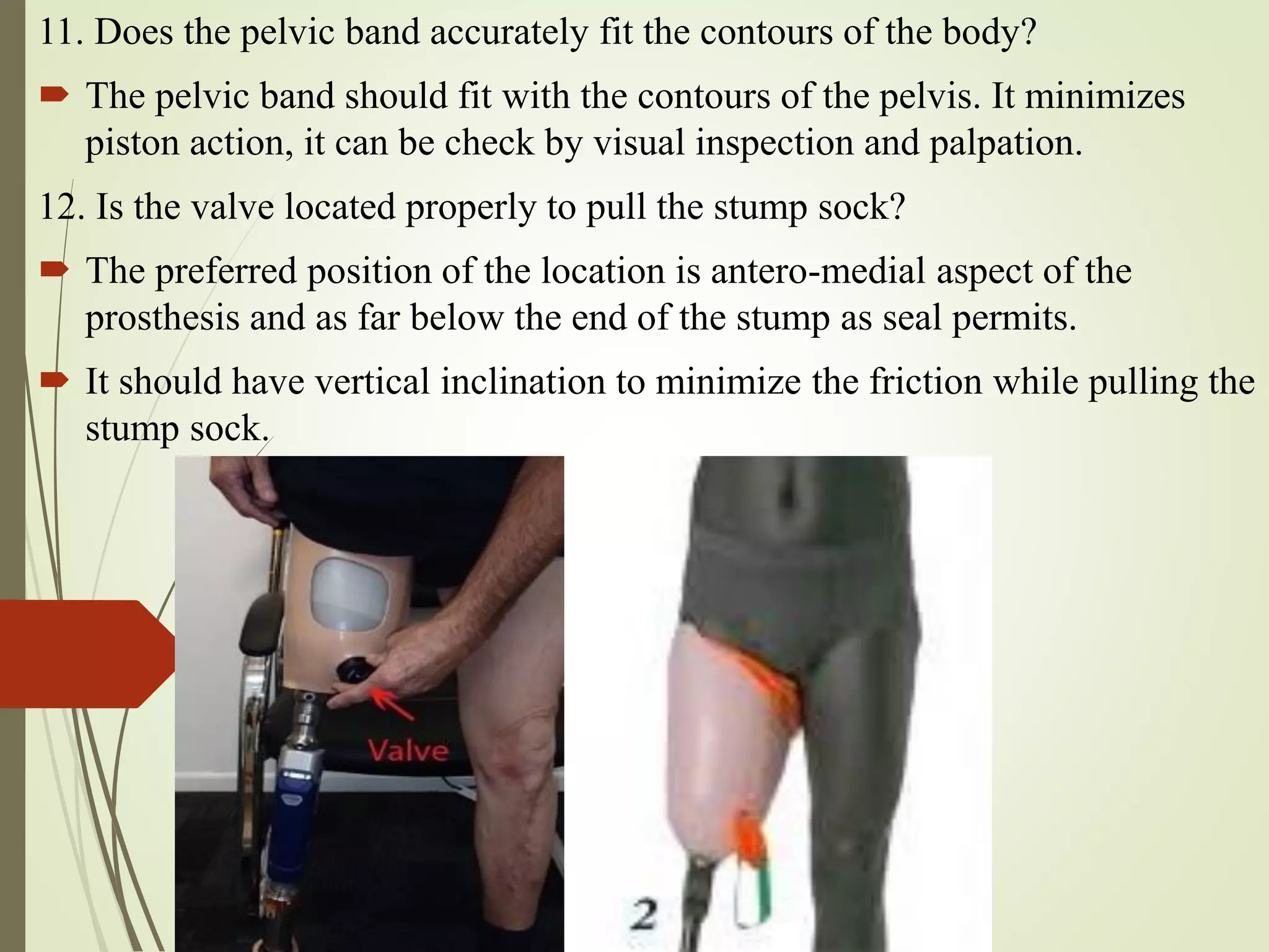 11. Does the pelvic band accurately fit the contours of the body?
 The pelvic band should fit with the contours of the pelvis. It minimizes
piston action, it can be check by visual inspection and palpation.
12. Is the valve located properly to pull the stump sock?
 The preferred position of the location is antero-medial aspect of the
prosthesis and as far below the end of the stump as seal permits.
 It should have vertical inclination to minimize the friction while pulling the
stump sock.
 