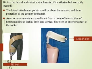 10. Are the lateral and anterior attachments of the silesian belt correctly
located?
 The lateral attachment point should be about 6mm above and 6mm
posteriors to the greater trochanter.
 Anterior attachments are equidistant from a point of intersection of
horizontal line at ischial level and vertical bisection of anterior aspect of
the socket.
Silesian belt
TES belt
 