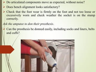  Do articulated components move as expected, without noise?
 Does bench alignment looks satisfactory?
 Check that the foot wear is firmly on the foot and not too loose or
excessively worn and check weather the socket is on the stump
correctly.
Ask the amputee to don their prosthesis.
 Can the prosthesis be donned easily, including socks and liners, belts
and cuffs?
 
