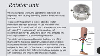 Socket Rotator Below knee prosthetic components.pptx