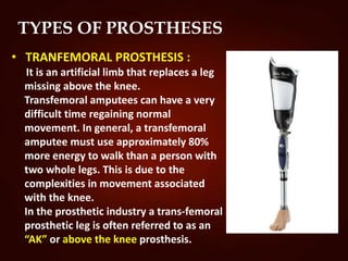 TYPES OF PROSTHESES
• TRANFEMORAL PROSTHESIS :
It is an artificial limb that replaces a leg
missing above the knee.
Transfemoral amputees can have a very
difficult time regaining normal
movement. In general, a transfemoral
amputee must use approximately 80%
more energy to walk than a person with
two whole legs. This is due to the
complexities in movement associated
with the knee.
In the prosthetic industry a trans-femoral
prosthetic leg is often referred to as an
“AK” or above the knee prosthesis.
 