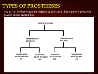 TYPES OF PROSTHESES
Any part of the body could be replaced by prosthesis , but in general prosthetic
devices can be divided into -
 