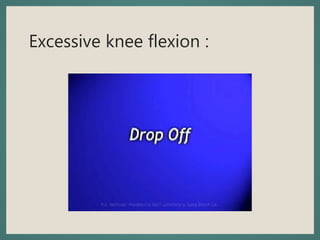 Excessive knee flexion :
 